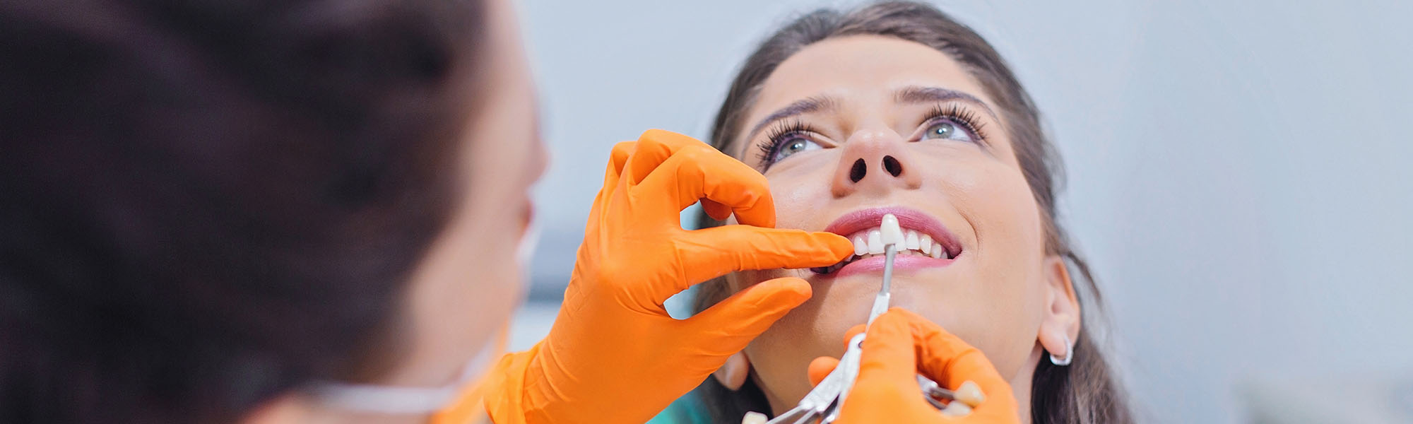 Am I a Good Candidate for Veneers? in El Segundo Modern Dentistry Blog Image