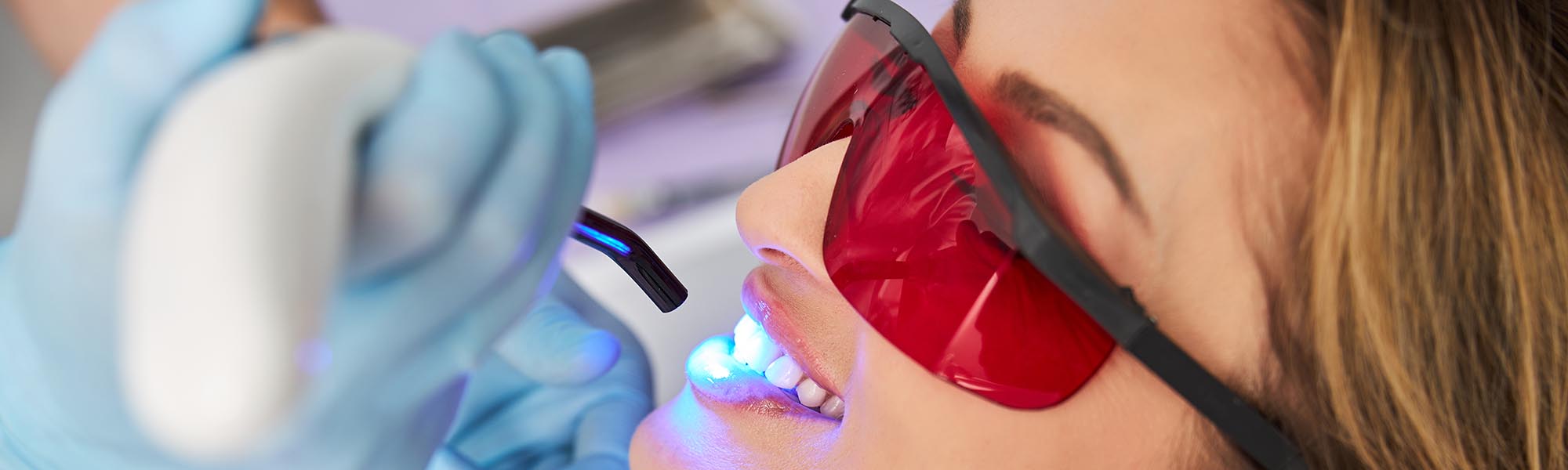 Teeth Whitening in El Segundo CA